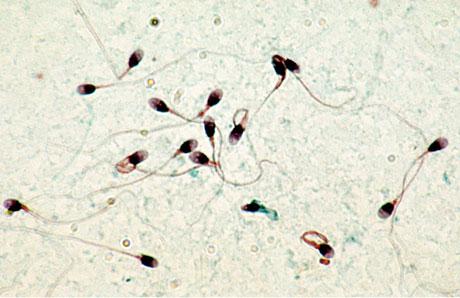 Spermatozoïdes : Certaines protéines auraient un double rôle