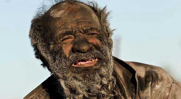 Amoo Hadji : l’homme le plus sale du monde – 60 ans sans se laver