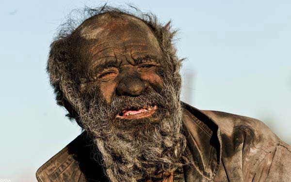 Amoo Hadji l'homme le plus sale du monde - 60 ans sans se laver Amoo Hadji : l'homme le plus sale du monde - 60 ans sans se laver