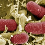 L’augmentation de cas d’infection de la bactérie C chez les enfants préoccupe