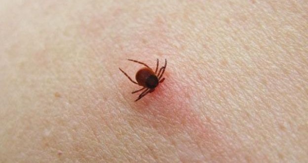 Maladie de Lyme : Soyez plus vigilants et protégez-vous