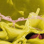 Bactérie Salmonella : Des cas d'infection enregistrés au Canada