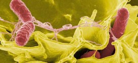 Bactérie Salmonella : Des cas d'infection enregistrés au Canada